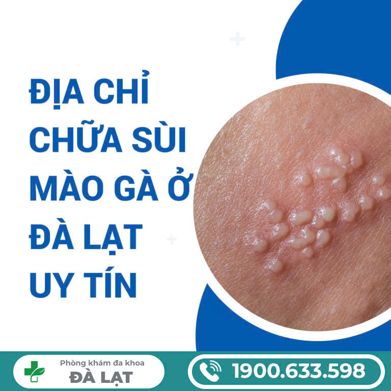 Hình ảnh minh họa